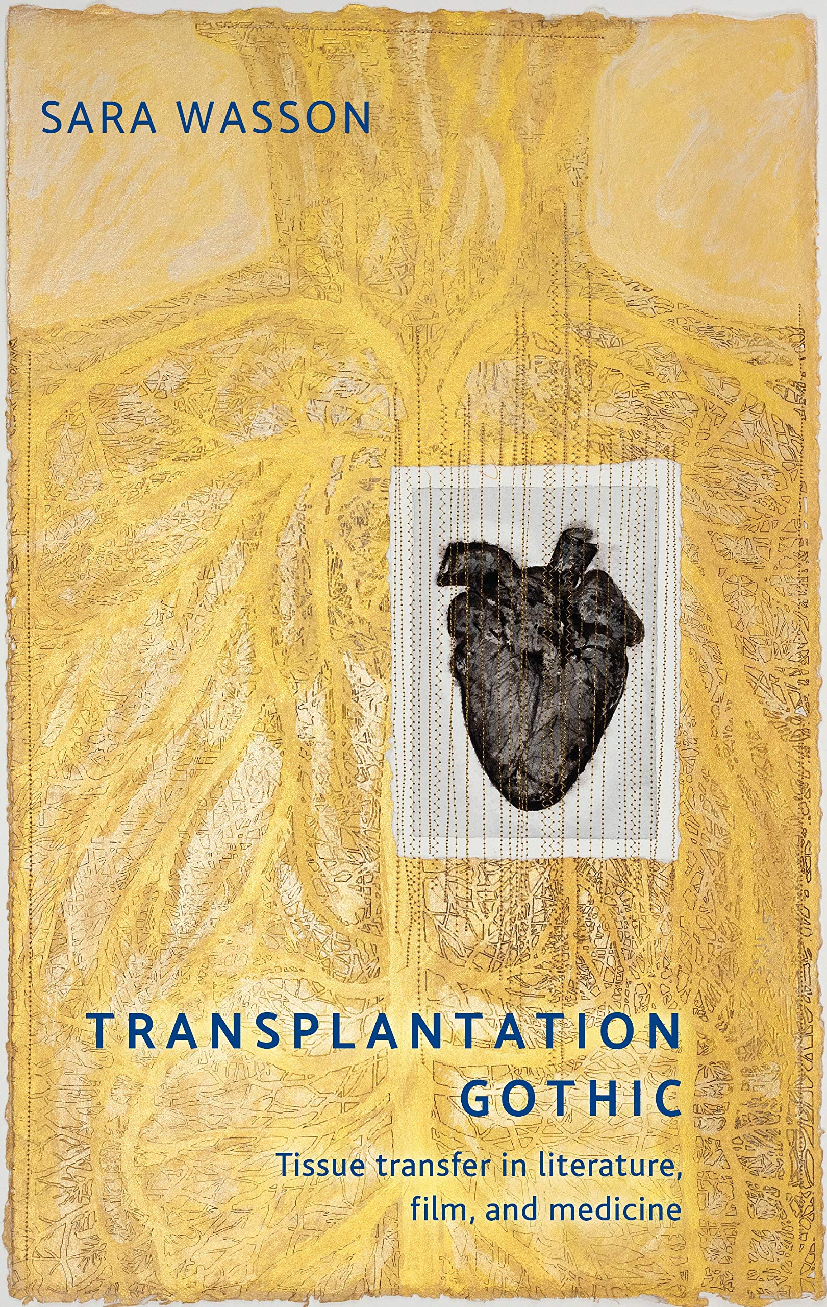 Transplantation Gothic cover